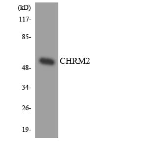 Polyclonal Rabbit anti-Human CHRM2 / M2 Antibody (aa175-224, WB)