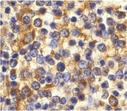 CCR3 Antibody (C-Terminus)