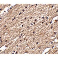 SPRED3 Antibody