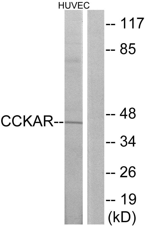 Polyclonal Rabbit anti-Human CCKAR / CCK1R Antibody (WB)
