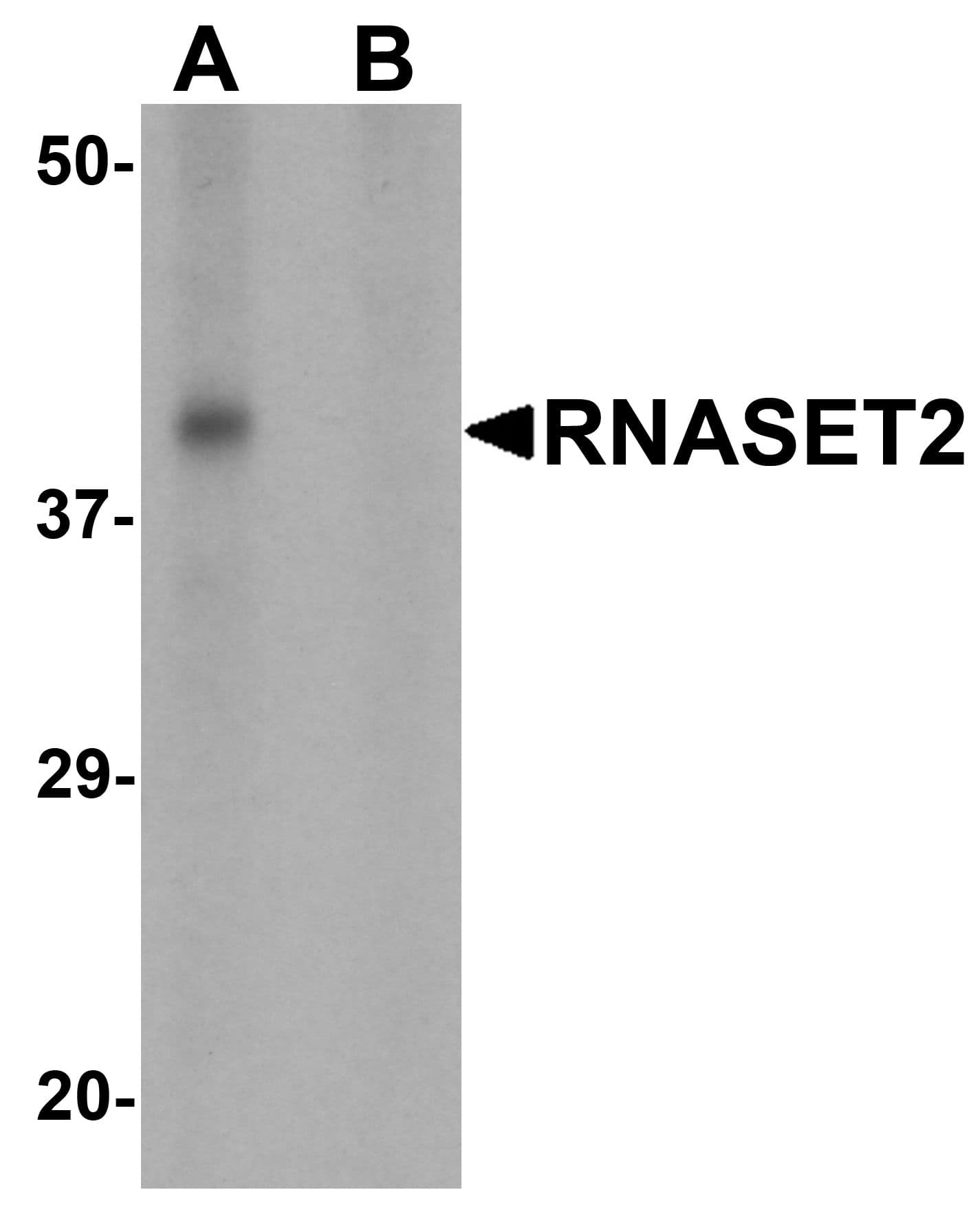 IHC-plus™ Polyclonal Rabbit anti-Human RNASET2 Antibody (IHC, IF, WB)