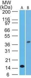 IL-1B / IL-1 Beta Antibody (clone 43N3D8)