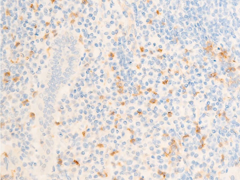 ICAM-1 / CD54 Antibody (phospho-Tyr512)
