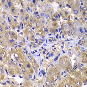 CARD10 / CARMA3 Antibody