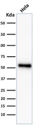 TP53 / p53 Antibody (clone TP53/2092R)
