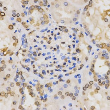 Histone H3 Antibody (Di-Methyl-Lys36)