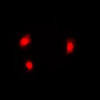 Polyclonal Rabbit anti-Human C11orf30 / EMSY Antibody (IF, WB)