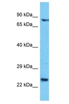 Polyclonal Rabbit anti-Human DCAF16 Antibody (FITC, aa16-65, WB)