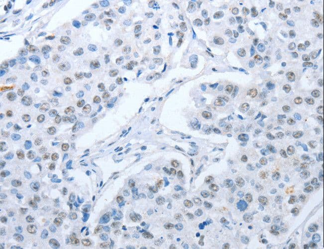 ARHGEF2 / GEF-H1 Antibody