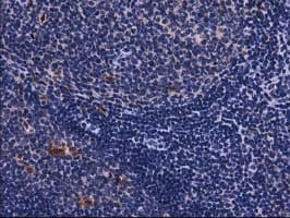 Monoclonal Mouse anti-Human SQSTM1 Antibody (clone OTI5A1, IHC, IF, WB)