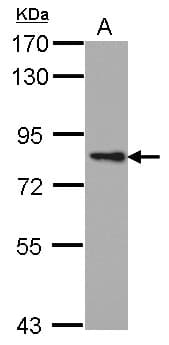 Polyclonal Rabbit anti-Human PRKCE / PKC-Epsilon Antibody (Internal, WB)
