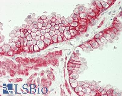 PathPlus™ CTNND1 / p120 Catenin Antibody (aa891-C-term)