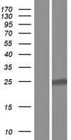 Human COMMD7 Protein (Over-Expression Lysate Myc-DDK (Flag))