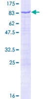 Human NMT1 Protein (Recombinant GST)