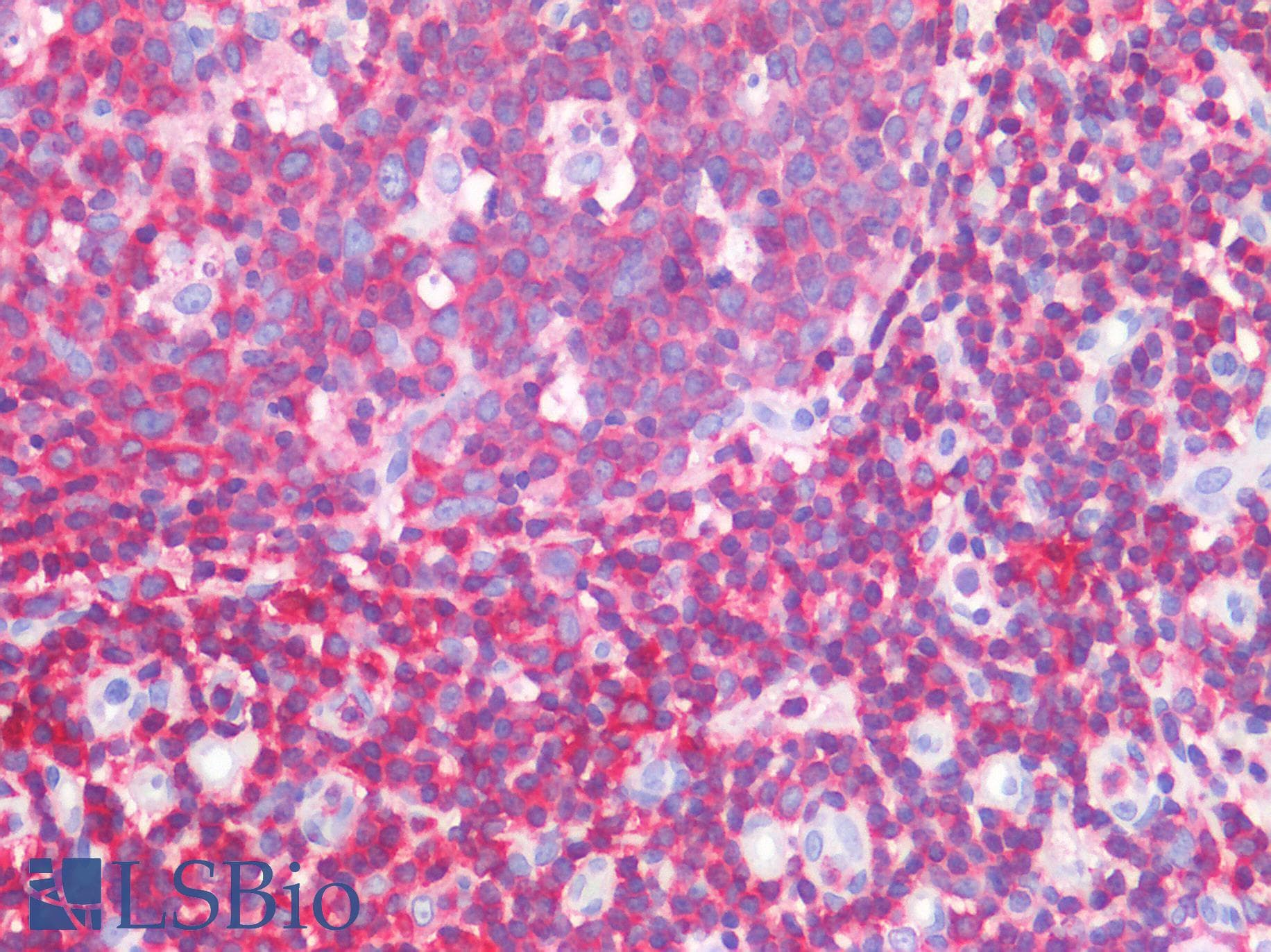 PathPlus™ Polyclonal Rabbit anti-Human LSP1 Antibody (IHC, WB)
