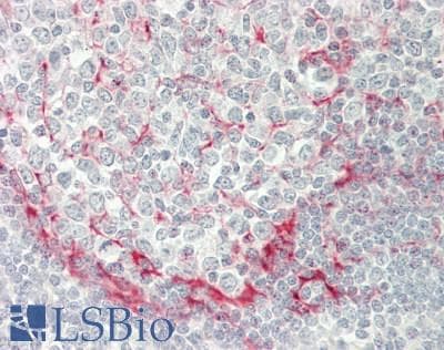 IHC-plus™ DMN / Desmuslin / Synemin Antibody (aa329-580, clone 2F4)