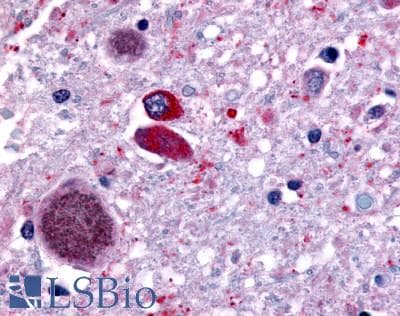 PathPlus™ FFAR2 / GPR43 Antibody (Extracellular Domain)
