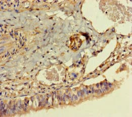 DPH7 / WDR85 Antibody