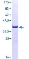 Human IMMT / Mitofilin Protein (Recombinant GST, N-terminus)
