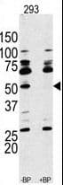 RPS6KB1 / P70S6K / S6K Antibody (aa277-306)