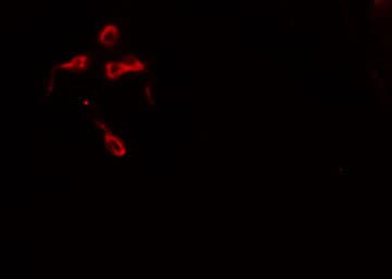 Polyclonal Rabbit anti-Human DOK1 Antibody (IHC, IF, WB)