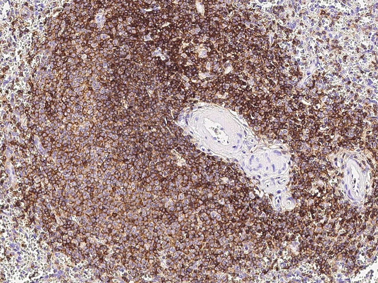 Monoclonal Mouse anti-Human CD45 / LCA Antibody (clone 15, Preservative Free, IHC, WB)