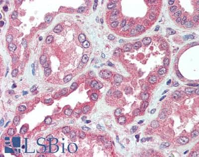 IHC-plus™ FGF23 Antibody