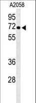 ATP6V1A1 / ATP6V1A Antibody (aa441-468)