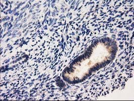 RASSF1 / RASSF1A Antibody (clone OTI2B11)
