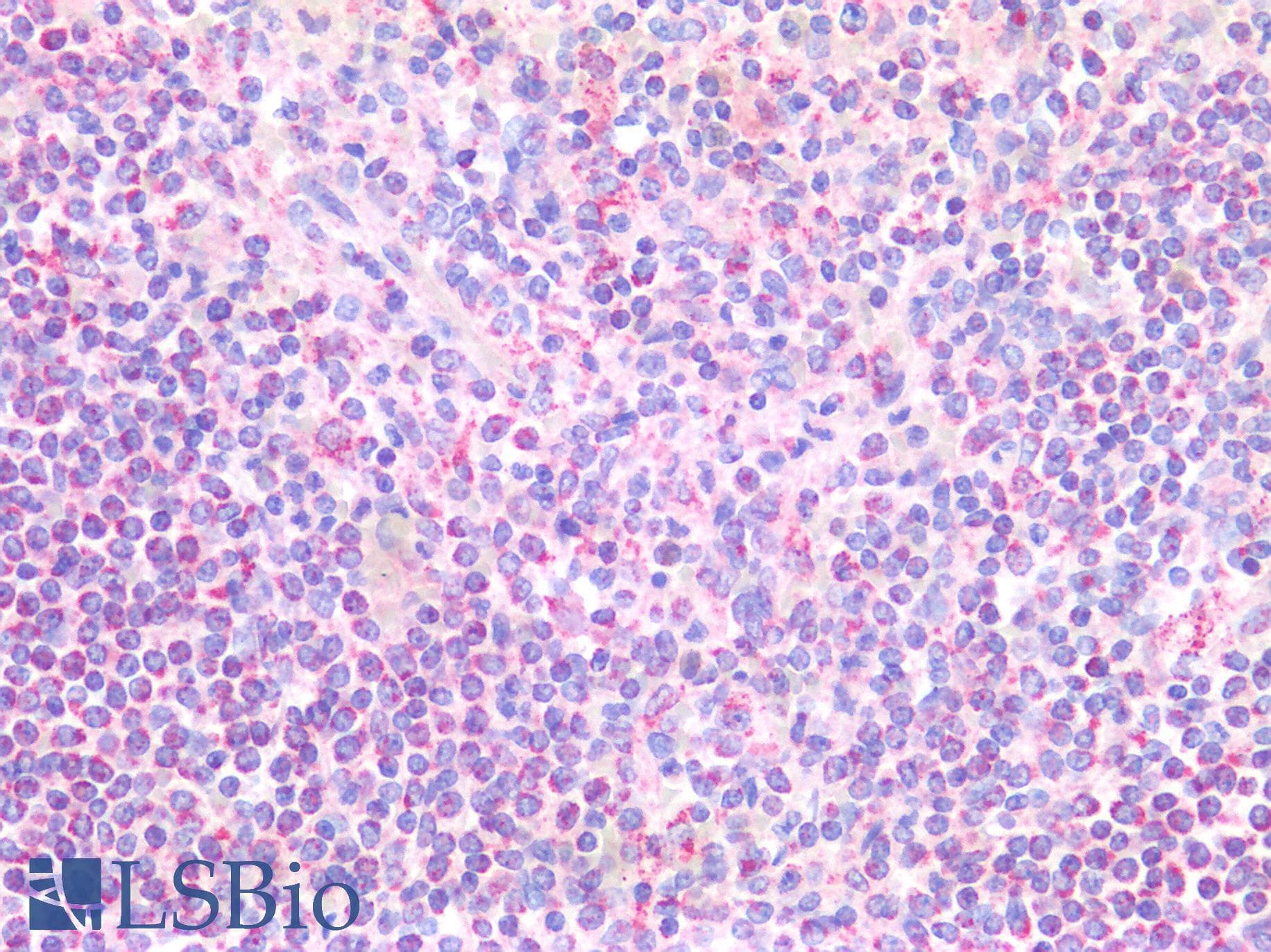 PathPlus™ Polyclonal Rabbit anti-Human RAB7A / RAB7 Antibody (IHC)