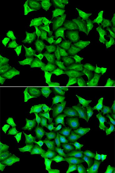 SEPSECS Antibody
