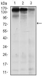 IHC-plus™ Monoclonal Mouse anti-Human MSH6 Antibody (clone 5B11, aa217-395, IHC, WB)