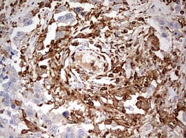 DOCK2 Antibody (aa1544-1830, clone OTI4E12)