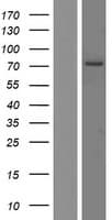 RGS9 Protein (Over-Expression Lysate Myc-DDK (Flag))