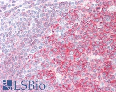 IHC-plus™ SWAP70 Antibody (aa572-585)