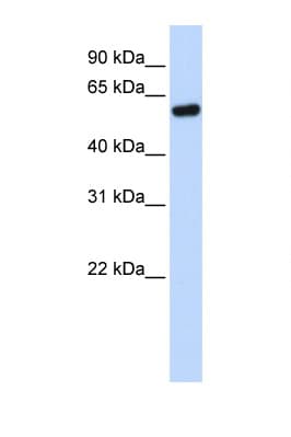 TP53 / p53 Antibody (N-Terminus)