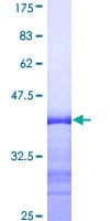 Human MYOC / Myocilin Protein (Recombinant GST, N-terminus)