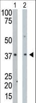 PDXK / PNK Antibody (aa1-30)