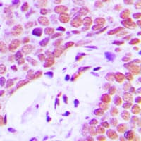 XRCC5 / Ku80 Antibody (C-Terminus)