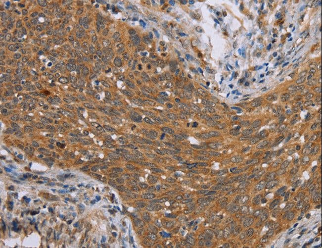 ADAMTS15 Antibody