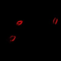 Polyclonal Rabbit anti-Human CAPZA2 / CAPZ Alpha 2 Antibody (IF, WB)