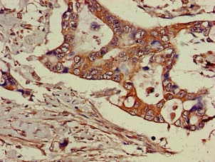 GGA3 Antibody
