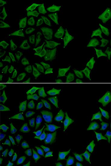 TCN1 Antibody