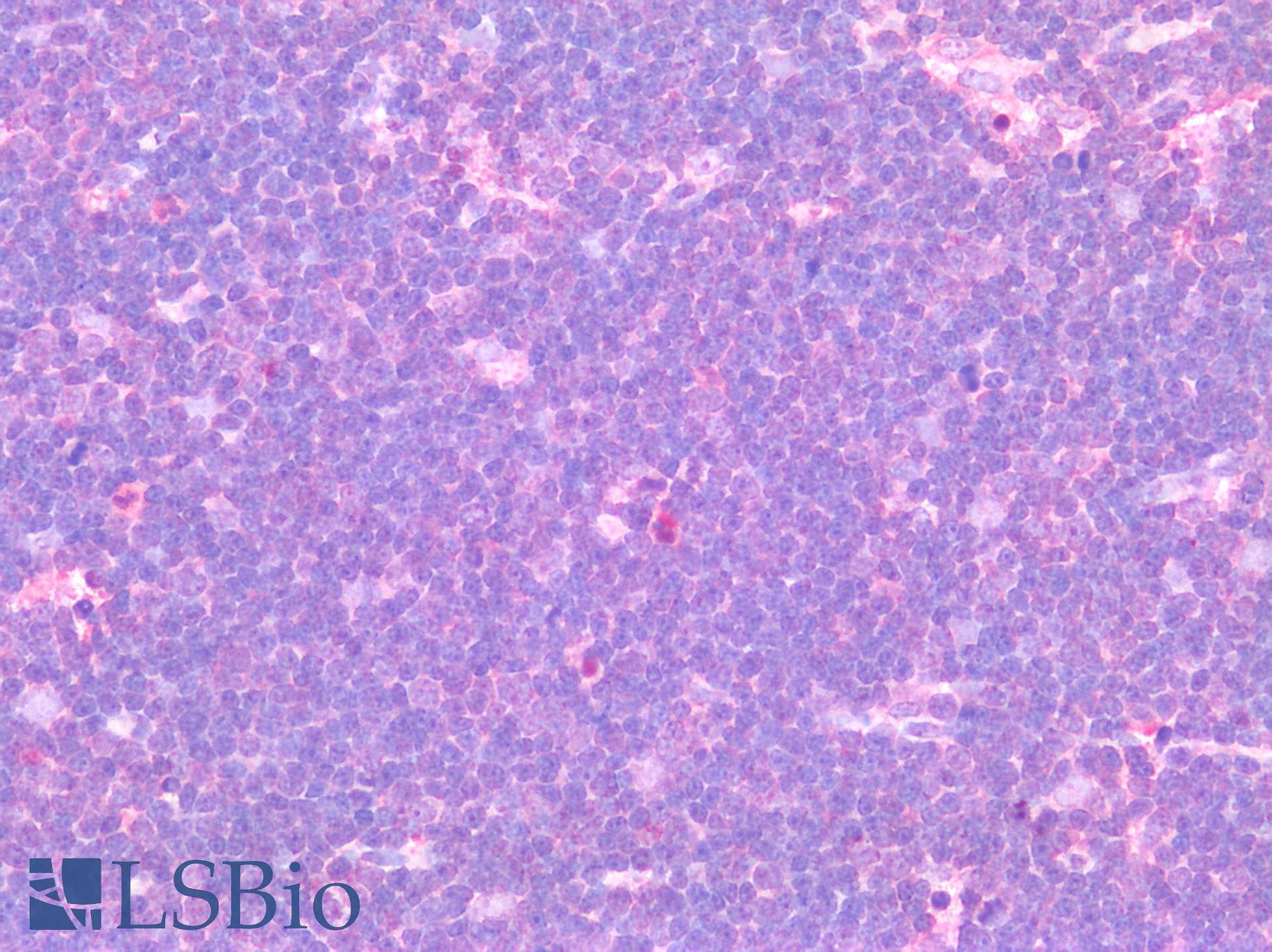 IHC-plus™ Polyclonal Rabbit anti-Human TSLP Antibody (IHC)