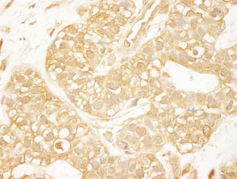 ARHGEF11 Antibody (aa125-175)