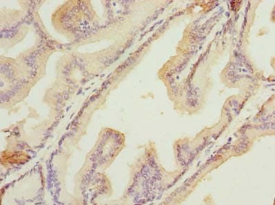 HSDL2 Antibody
