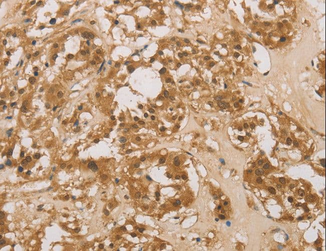 Polyclonal Rabbit anti-Human DACH / DACH1 Antibody (IHC)