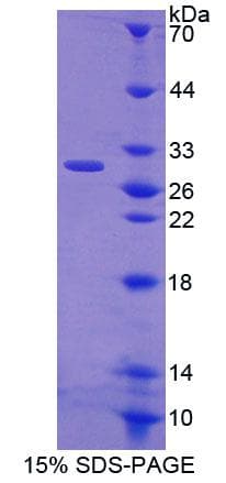 Rat CRISP1 Protein (Recombinant His-T7)