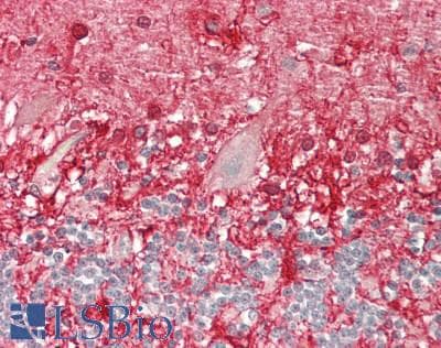 IHC-plus™ CRHR2 / CRF2 Receptor Antibody (His112)