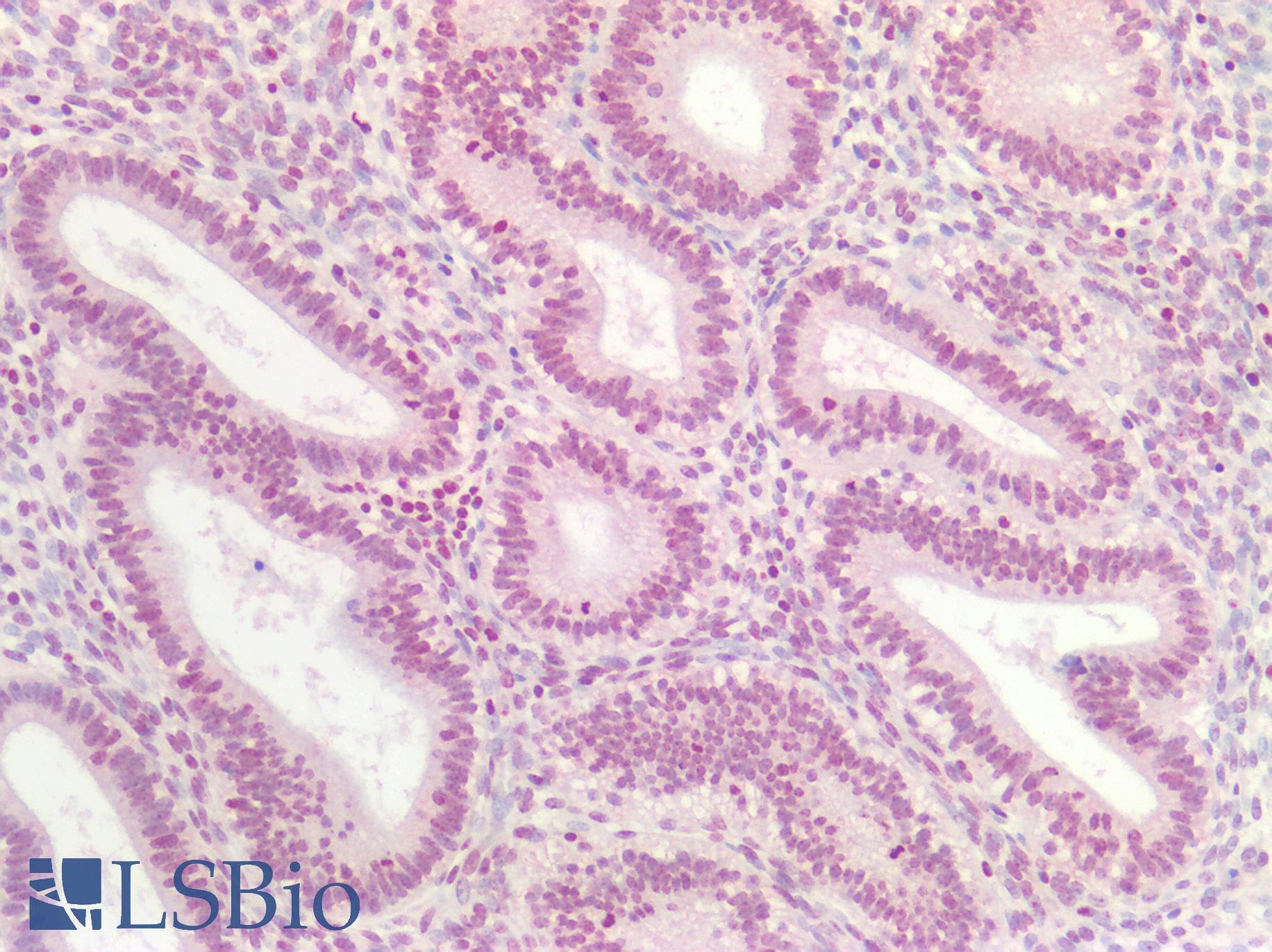 PathPlus™ AKT1 Antibody